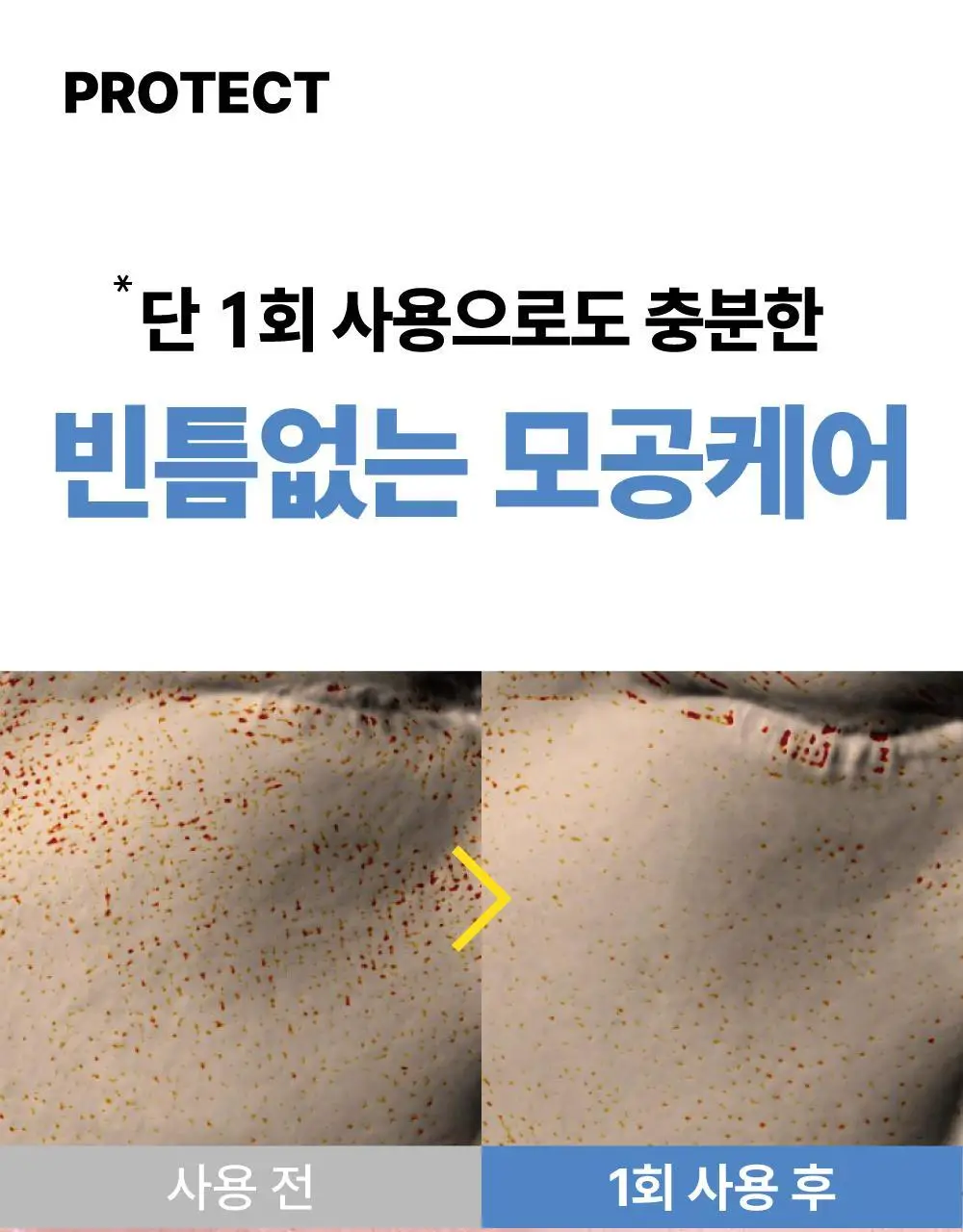 [500억유산균팩] 써니콘 마이크로바이옴 유산균 모델링팩 (7개입) 상세페이지 26